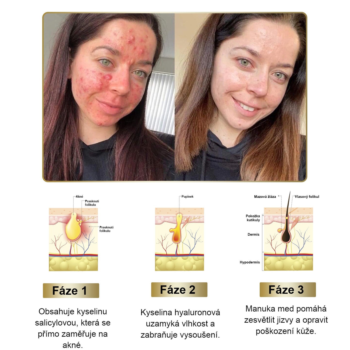 💎Gratulujeme! 🎉 Dnes jste náš 500. zákazník a získáváte speciální nabídku: druhý produkt se slevou 50 %!